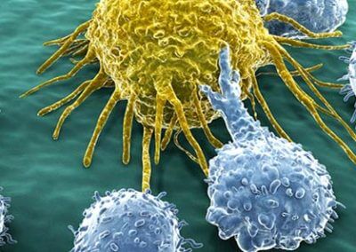 Immunotherapy: Immunocheckpoint Inhibitors & Beyond   Session Chair: Irv Weissman, Stanford School of Medicine